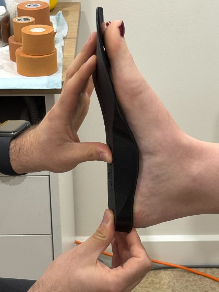 Orthotics for Bunions