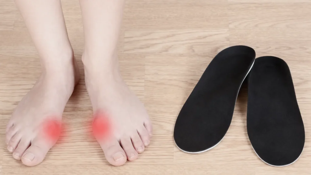Bunion